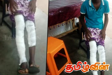 பழிவாங்கும் நோக்கில் சக மாணவனுக்குத் தீமூட்டிய மாணவர்கள்!