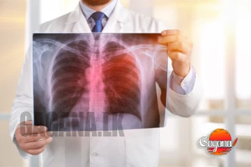 පසුගිය වසරේ ක්ෂය රෝගීන් 9200ක්