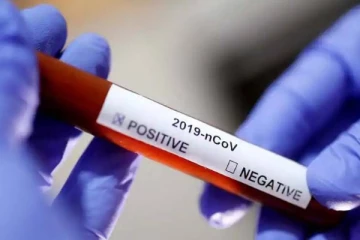 வடக்கு மாகாணத்தில் மேலும் 20 பேருக்கு கோவிட் தொற்று உறுதி