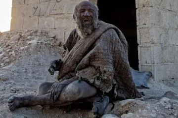 ஐம்பது வருடங்களாக குளிக்காமல் இருந்த நபர் மரணம்!