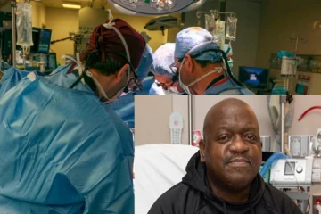 அமெரிக்காவில் பன்றி சிறுநீரகம் பெருத்தப்பட்ட நபருக்கு 2 மாதங்களில் நேர்ந்த சோகம்!