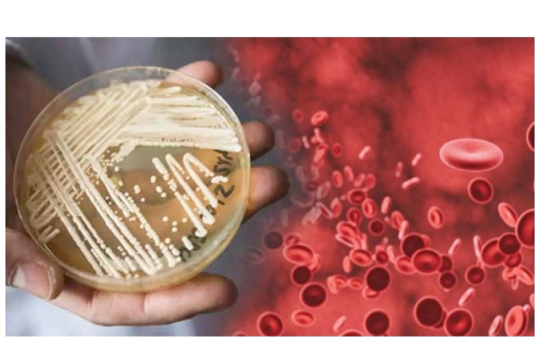 நேரடியாக ரத்த ஓட்டத்தை பாதித்து மரணத்தை கொடுக்கும் ‘கேண்டிடா ஆரிஸ்’ - புதிய பூஞ்சை கண்டுபிடிப்பு - அமெரிக்கா எச்சரிக்கை! | World