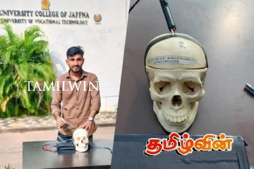 மூளையில் உள்ள கட்டிகளை அடையாளம் காண புதிய இயந்திரம் கண்டுபிடிப்பு