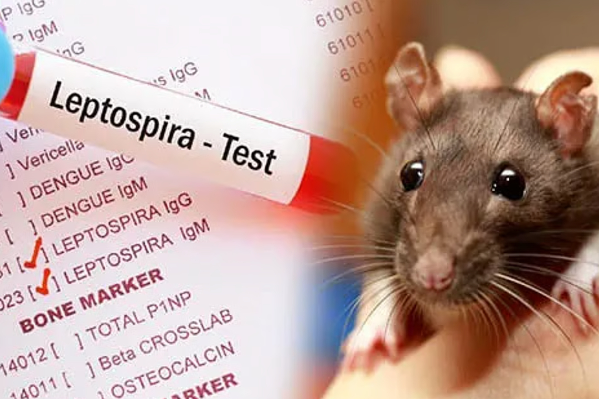 உடன் வைத்தியரை நாடவும்! காய்ச்சல் இருப்பவர்களுக்கு அவசர எச்சரிக்கை | Rat Fever Risk During New Year Festivities