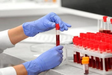 அதிகாரிகள் வெளியிடும் கோவிட் புள்ளி விபரங்கள் முற்றிலும் பொய்யானது! - பொது சுகாதார பரிசோதகர்களின் சங்கம்