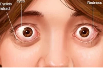 உங்க ஒட்டுமொத்த வாழ்வையே பாதிக்கும் ஆபத்தான நோய்....உடனே மருத்துவரை சந்தியுங்கள்