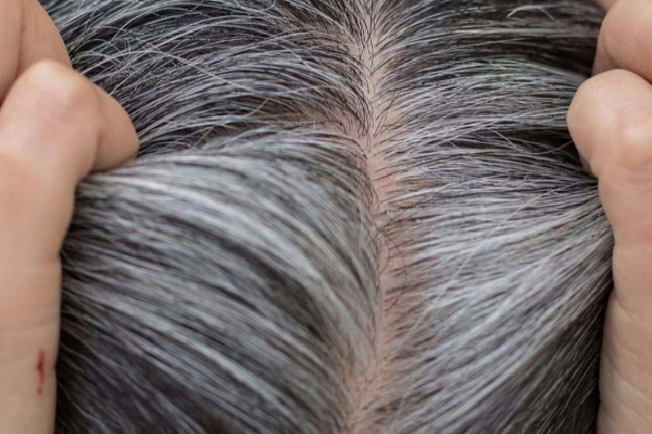 நரைமுடி கருப்பாக மாற - 7 நாட்கள் இதை தொடர்ந்து போடுங்க போதும் | Natural Hair Dye Turn Grey Hair Black Within 7 Day