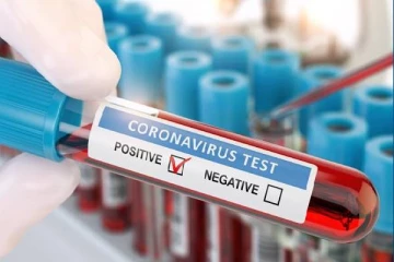 தெல்லிப்பளை பிரதேச செயலகத்தில் 8 பேருக்கு கொரோனா தொற்று