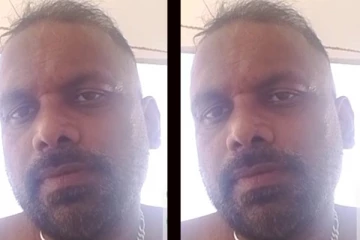 பெண் மீது அசிட் வீசியவரை தேடும் பொலிஸார்!