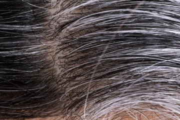 நீங்கள் இளநரையால் அவஸ்தைப்படுறீங்களா? அதனை போக்க சில எளிய வழிகள்