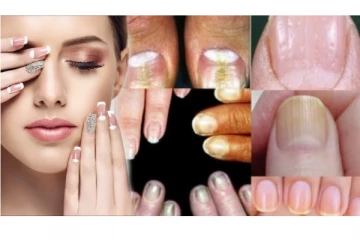 உங்கள் நகங்களின் நிறம் காட்டும் உடல் ஆரோக்கியத்தை தெரிந்து கொள்ளுங்கள்!