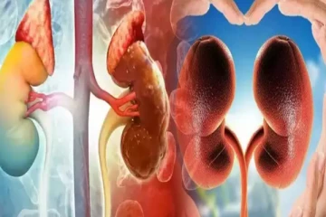 உங்களுக்கு இந்த அறிகுறிகள் இருக்கா? சிறுநீரக பிரச்சனையாம்