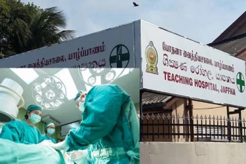 யாழ் போதனா வைத்தியசாலையில் சிகிச்சைக்காக அனுமதிக்கப்பட்ட சிறுமியின் கை அகற்றம்!