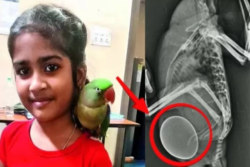 கிளியின் உடலில் சிக்கிய முட்டை... உயிரை காப்பாற்ற போராடும் சிறுமி!