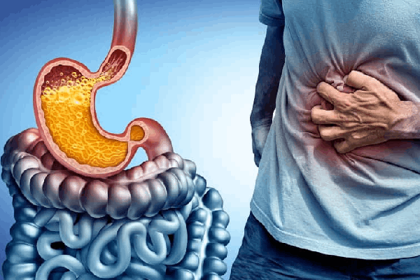 මේවා කළොත් ගැස්ට්‍රයිටීස් රෝගයට නිට්ටාවටම තිත  | Gastritis Causes Symptoms And Natural Cure