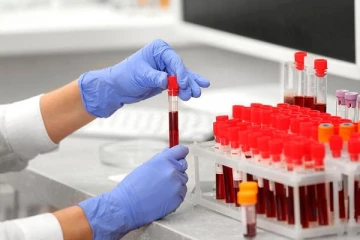 வவுனியாவில் 7 பேருக்கு கோவிட் தொற்று உறுதி