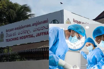 யாழ்.போதனா வைத்தியசாலையில் வெற்றிகரமாக இடம்பெற்ற சத்திர சிகிச்சை!