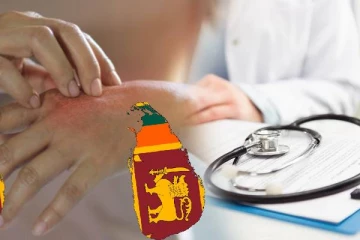 இலங்கையில் அதிகரிக்கும் தோல் புற்றுநோயாளர்கள்: விடுக்கப்பட்டுள்ள எச்சரிக்கை