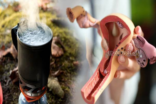 கொதி நீரை பயன்படுத்துறீங்களா? மருத்துவர் எச்சரிக்கை | Boiling Water On Your Vagina