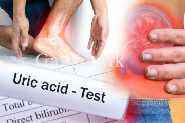 ලෙඩ වැඩි කරන යූරික් අම්ලය පාලනය කරන මෙන්න මේ ක්‍රම ගැන අහලා තියෙනවද ? - (VIDEO)