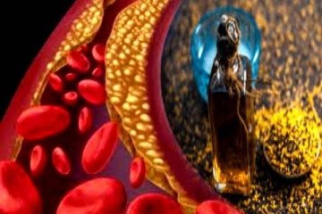 கெட்ட கொழுப்பை விரட்டியடிக்கும் கடுகு! யாரெல்லாம் சாப்பிடலாம்