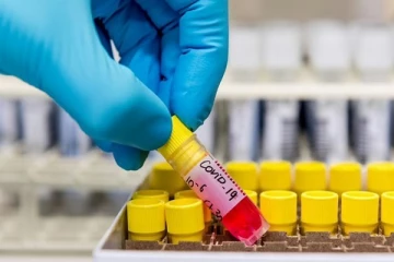 முல்லைத்தீவு மாவட்டத்தில் இதுவரை 1194 பேர் கோவிட் தொற்றாளர்களாக அடையாளம்