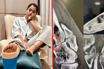 காலில் கட்டுடன் வீல்சேரில் உலா வரும் ராஷ்மிகா- நடந்தது என்ன? அவரே வெளியிட்ட பதிவு