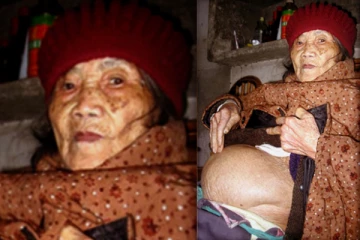 கல்லாக மாறிய கரு; 31 வயதில் கர்ப்பமாகி 90 வயதில் பிரசவித்த பெண்