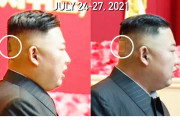 தலையில் பேண்ட்-எய்டுடன் பொது வெளியில் தோன்றிய கிம் ஜாங்-உன்! உடல்நிலை குறித்து வெளியான முக்கிய தகவல்