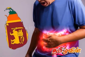 இலங்கை மக்களை எச்சரிக்கும் மருத்துவத்துறை
