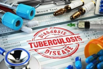 கனேடிய மாகாணமொன்றில் காசநோய் பரவுவதாக கனடா சுகாதாரத்துறை அறிவிப்பு