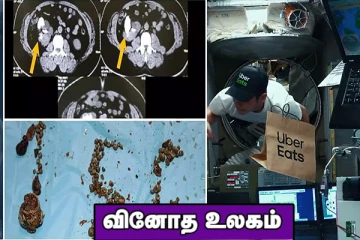 விண்வெளியில் உணவு டெலிவரி! கிட்னியிலிருந்த 156 கற்கள் அகற்றம்...வினோத உலகம்!