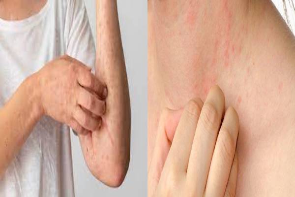 தோலில் இந்த அறிகுறிகள் இருக்கா? அப்போ கல்லீரல் ஆபத்தில் இருக்குதுன்னு அர்த்தம்! | What Are The Warning Signs Of A Damaged Liver
