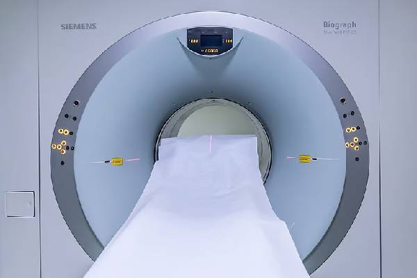 MRI Scan