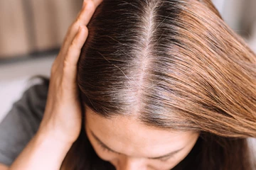 இளநரை தொல்லையா? ஷாம்போவுடன் இதை குளிக்கும் போது பூசுங்க.. தடம் தெரியாமல் மறையும்!