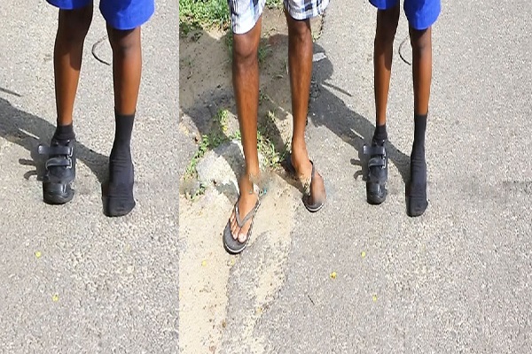 காலைவேளை பாடசாலை சென்ற மாணவனுக்கு ஏற்பட்ட நிலை | Person Forcibly Snatched A Shoe From A Student