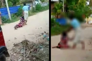 கணவரால் மிகக் கொடூரமாக தாக்கப்பட்ட பெண்