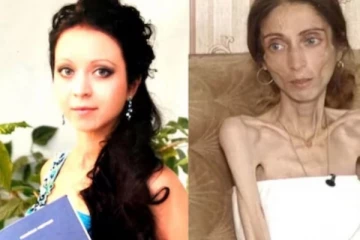 Chubby கன்னம் பிடிக்கல.. கணவனுக்காக பட்டினி கிடந்து மாறிய மனைவி - அதிரவைக்கும் சம்பவம்