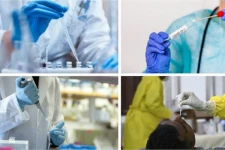 இலங்கையில் பி சி ஆர் பரிசோதனைக்கான மலைக்கவைக்கும் செலவு வெளியானது