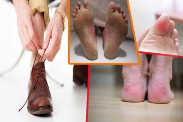 சாக்ஸ் அணியாமல் ஷூ போடுறீங்களா? அப்போ இந்த பாதிப்புகள் உறுதி