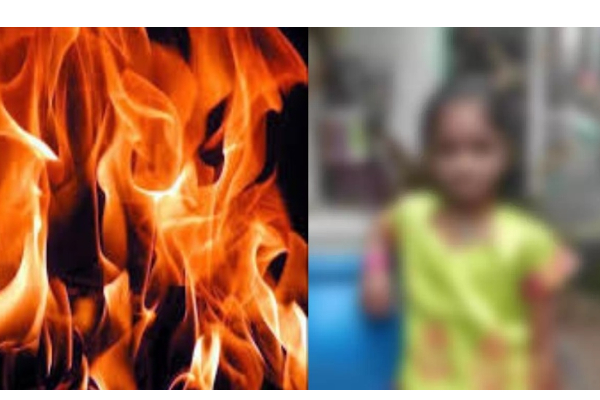 9 வயது குழந்தை உடலில் தீ வைத்து கொளுத்திய கொடூரச் சம்பவம் - போலீசார் தீவிர விசாரணை - தமிழ்நாடு