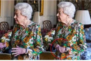 பிரித்தானிய ராணியாரின் கைகள் நிறம் மாறியிருப்பது ஏன்?