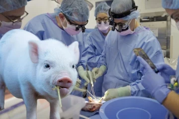 உறுப்பு மாற்று அறுவை சிகிற்சை ; பன்றியின் சிறுநீரகத்தை பொருத்தி சாதனை