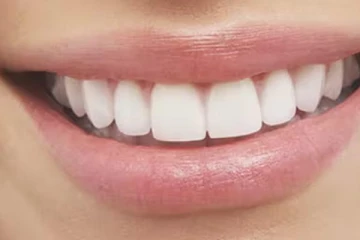 பற்களை இயற்கையாக வெண்மையாக்க வேண்டுமா? இதோ சில அற்புத இயற்கை வழிமுறைகள்!