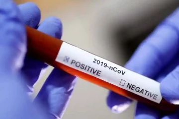 கோவிட் - 19 பரவல்! - சுவிஸ் அரசின் புதிய அறிவிப்புகள்