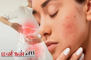 உடலில் கல்லீரல் சேதமடைந்தால் முகத்தில் காட்டும் அறிகுறிகள் என்ன?
