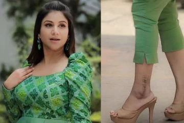 காலில் இவ்வளவு பெரிய தழும்பா!! சீரியல் நடிகை ஆல்யா மானசாவிற்கு என்ன ஆச்சு