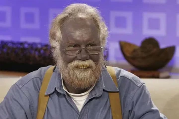 சுவிஸ் மாகாணம் ஒன்றில் உலாவரும் நீல நிற மனிதர்... மருத்துவர்கள் எச்சரிக்கை