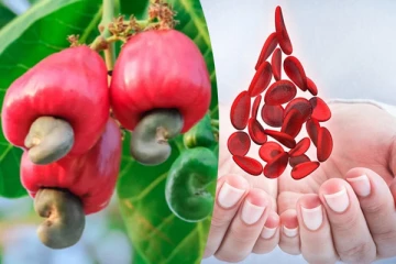 ரத்த சோகையால் அவதிப்படுறீங்களா? தினமும் ஒரு முந்திரி பழம் சாப்பிடுங்க