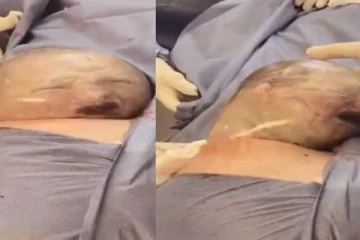 பனிக் குடத்துடன் சிலிர்த்து கொண்டு வெளியே வரும் குழந்தை....இதுவரை யாரும் பார்த்திராத அரிய காட்சி